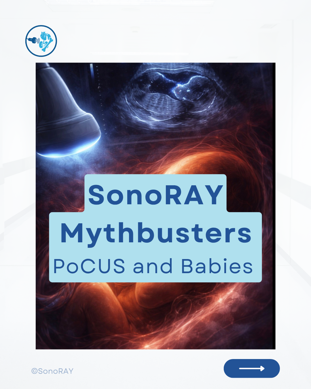 SonoRAY instagram content 2025-2026 (3).png